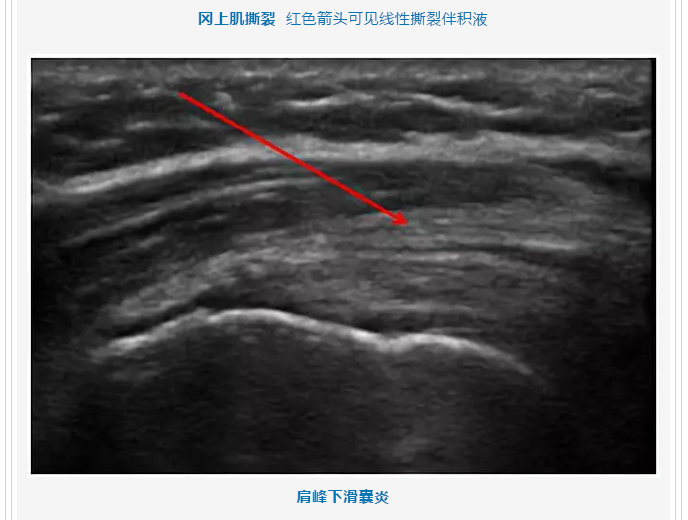 微信截图_20180814232717.png